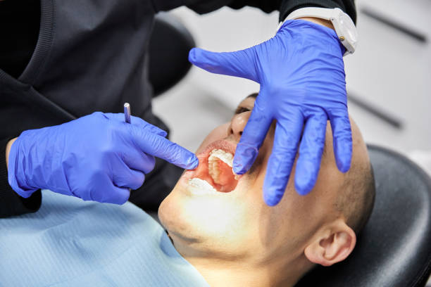 Best Root Canal Emergency Dentist  in Llano Grande, TX